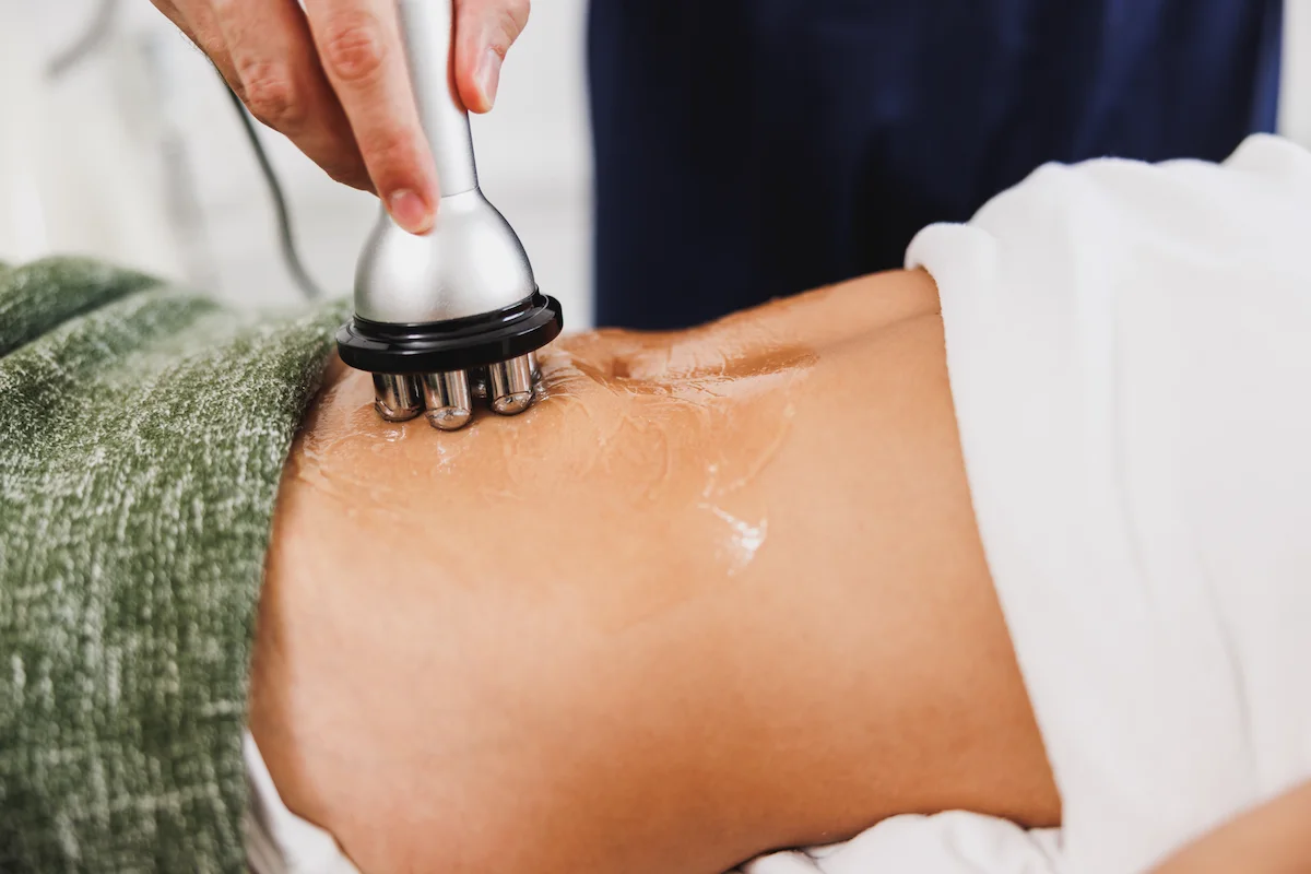 Dermatóloga aplicando el dispositivo Genesis de radiofrecuencia corporal en el abdomen de una paciente
