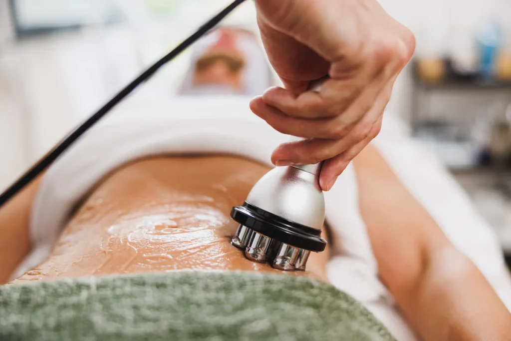 Mujer recibiendo una sesión de radiofrecuencia corporal en una clínica de dermatología en Quito